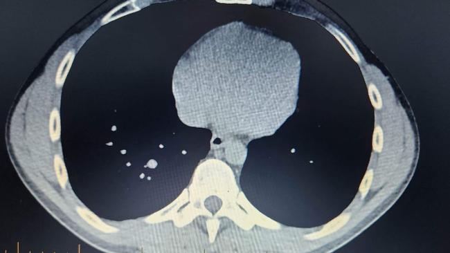 Mr Donnelly was diagnosed with silicosis, a disease that attacks the lungs, earlier this month. He awaits word on his life expectancy. Picture: Supplied.