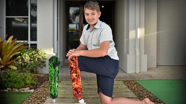 Kane Bilton, 14, has just received his custom-made prosthetic leg featuring a flame design he chose. Picture: Patrick Woods