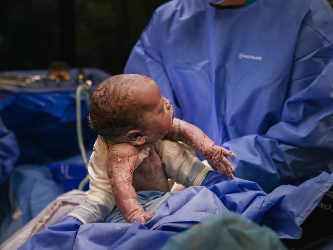 Ashleigh Confait helps deliver her own baby, Rosie Mae Marsh. Picture: Nicole Cleary