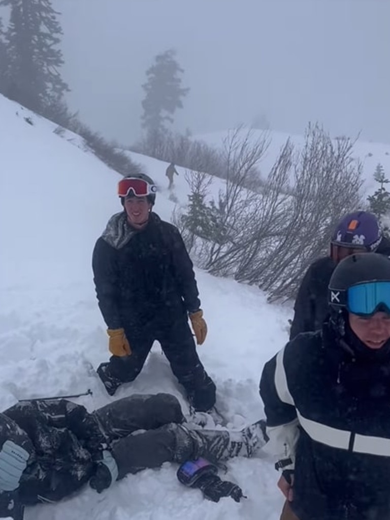 He broke his leg and dislocated his knee after getting swept over a cliff. Picture: Instagram (callumwishart)