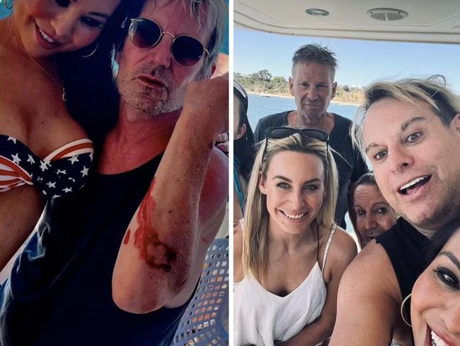 Brian Mannix has been "attacked by a shark". Picture: Instagram