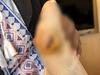 ‘Maggots in wound’: Horror aged care homes exposed