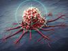Doctor busts common cancer myth