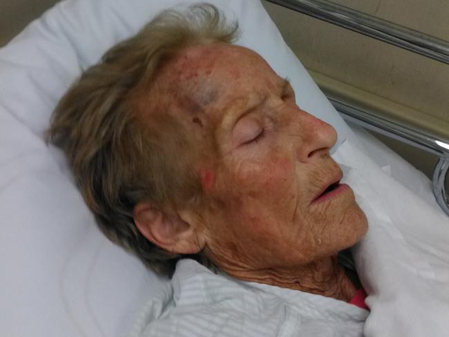 Martha Dapontes following an “unwitnessed fall’’ at St Vincent’s nursing home in Mitchelton.