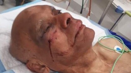 Sydney Ellis is in hospital after being savagely beaten outside Carrum Downs Plaza. Picture: Supplied