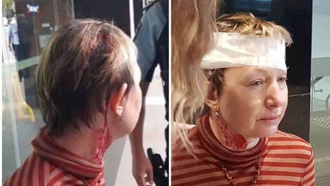 A woman has suffered head wounds from a metal projectile at a Ukrainian protest outside the German embassy in Sydney on April 26, around 12:55pm. Picture: Supplied