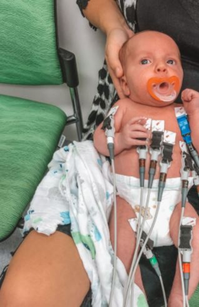 In 2019, Anakin Stimson was born with a complex form of congenital heart disease (CHD) where his heart’s right side aortic arch and left subclavian artery had not developed properly. Photo: contributed.