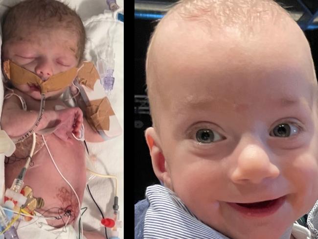 Hospital’s fight for machine that saved baby’s life