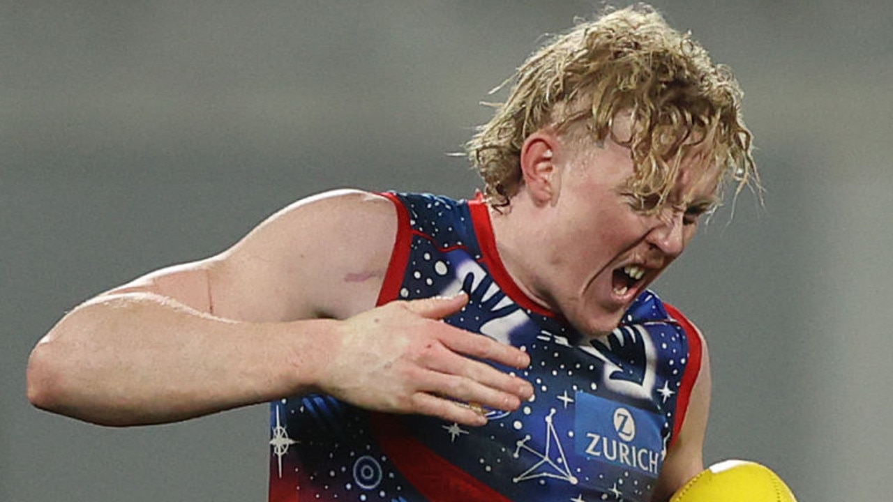 GEELONG, AUSTRALIA - JULY 07: Clayton Oliver of the Demons reacts after he was kicked in the hand during the round 17 AFL match between the Geelong Cats and the Melbourne Demons at GMHBA Stadium on July 07, 2022 in Geelong, Australia. (Photo by Robert Cianflone/Getty Images)