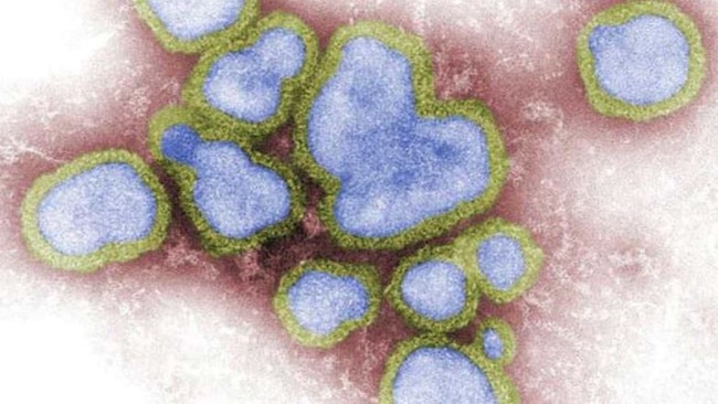 Influenza A (strain under a microscope) and other illnesses have been hitting the region hard near the end of winter.