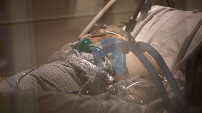 A ventilator in use for a COVID-19 patient. Picture: John Moore/Getty Images/AFP