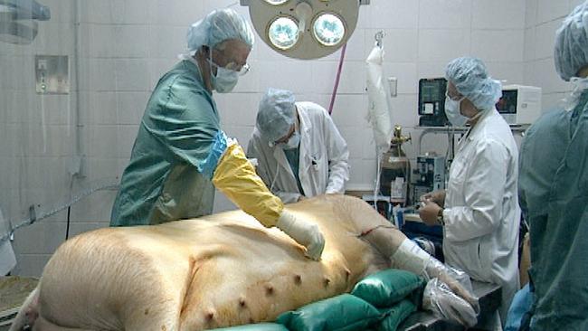 Surgeons perform operation on giant pig at an organ farm where they clone pigs to contain a piece of human genetic code or DNA.