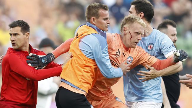 A bloodied Tom Glover is helped from the pitch after being hit by a bucket.