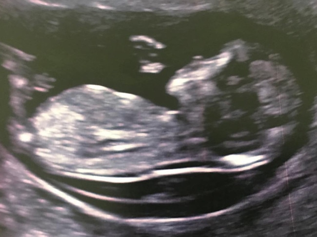 Thurston announced the surprise pregnancy on Instagram this week. Picture: Instagram