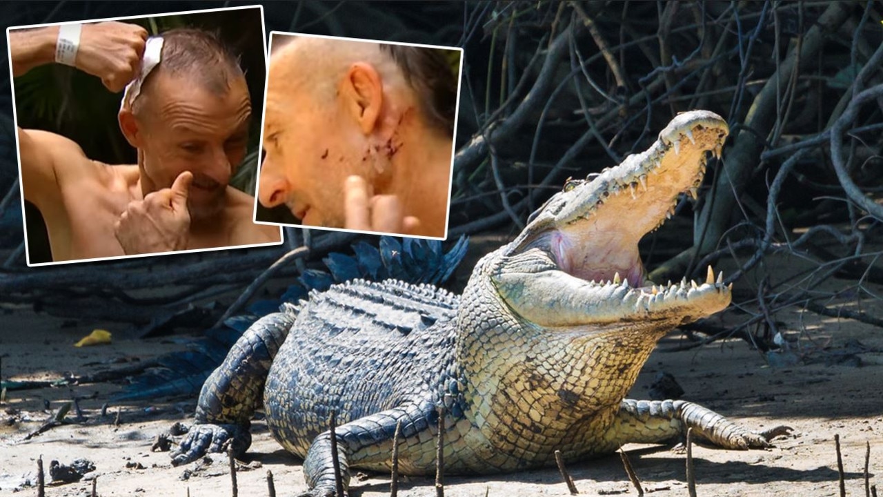 Australian Man Survives Crocodile Attack By Biting The Reptile On Its Eyelid