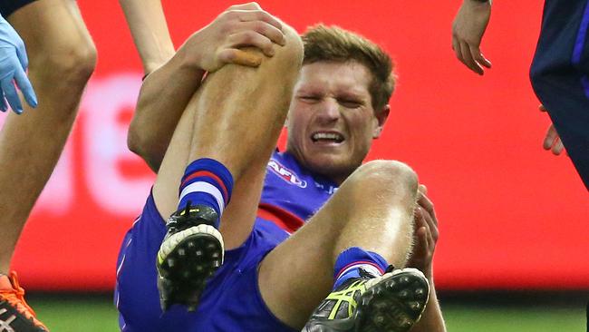 The agony on Jack Redpath’s face tells the story of his season-ending injury. Picture: Getty Images)