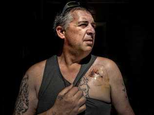 Gerry Reside shows off his scar after he was revived from a heart attack at the rear of the Grafton PO Hotel. He is looking for 'Dave', who gave him CPR and saved his life. Picture: Adam Hourigan