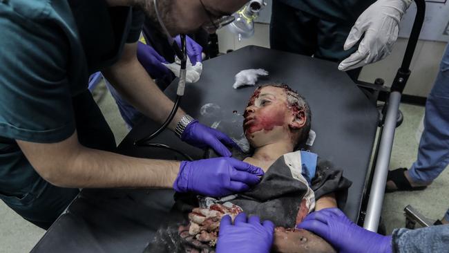 A Palestinian child is injured severely by Israeli airstrikes. Picure: Getty Images