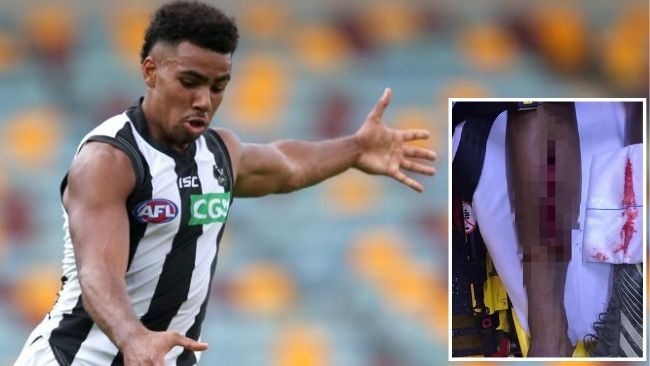 Collingwood Rising Star nominee Isaac Quaynor suffered a horrific gash to his leg thanks to a freak accident against Sydney.