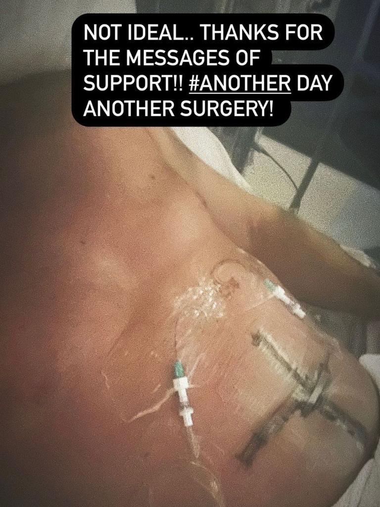 Former Geelong Footballer Steve Johnson posted a picture from hospital showing his injuries after stabbing himself with a knife. Picture: Instagram.