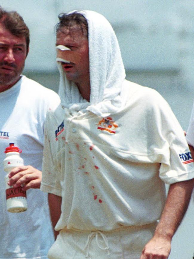 Steve Waugh is one tough bloke.