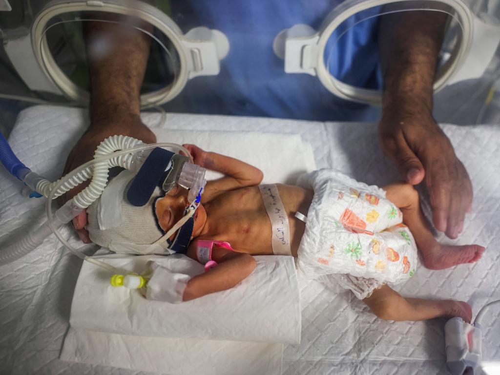 A medic cares for Sabreen al-Ruh al-Sheikh, a Palestinian baby delivered preterm by caesarean section minutes before the death of her mother, who was gravely injured in an Israeli air strike on Rafah. Picture: AFP