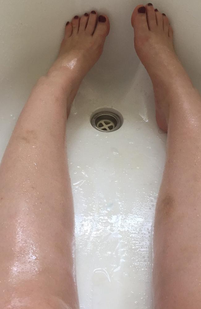 The image was posted with the caption ‘I am currently stuck in a bath’. Picture: Imgur