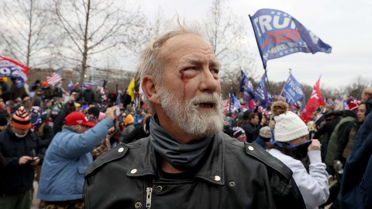 A man is seen bleeding during the brutal protests. Picture: Tasos Katopodis/Getty Images/AFP