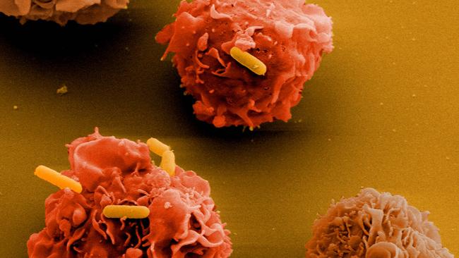 Listeria bacteria (yellow) invading human cells (orange). Picture: German Research Centre for Biotechnology