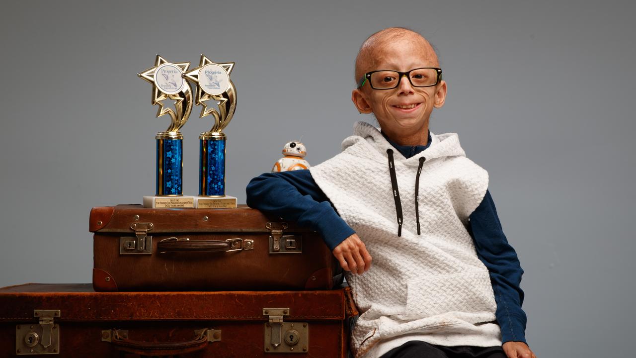 Enzo Cornejo has a very rare condition called progeria. Picture: Matt Turner