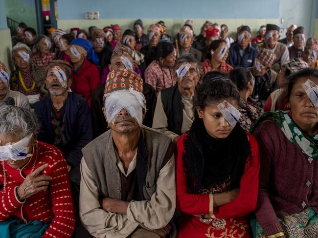 Some of the people Dr Sanduk Ruit helps with their eye issues in Nepal. Picture: Michael Amendolia