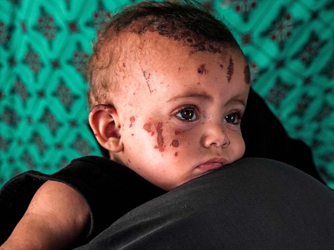 Palestinian toddler Rim Abu Hayya, the sole survivor from her family after they were killed by reported Israeli bombardment that hit their house in the east of Khan Yunis, is carried by her aunt Ayat in a tent shelter west of Khan Yunis in the southern Gaza Strip on August 13, 2024 amid the ongoing conflict in the Palestinian territory between Israel and Hamas. (Photo by Bashar TALEB / AFP)