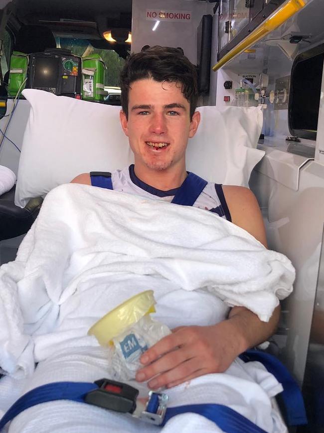 Andrew Brayshaw after the incident. Picture: Instagram