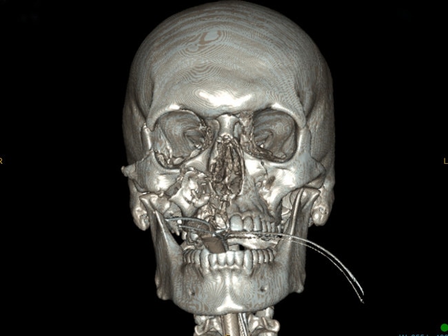 Zach Holden head scan from January 2022.