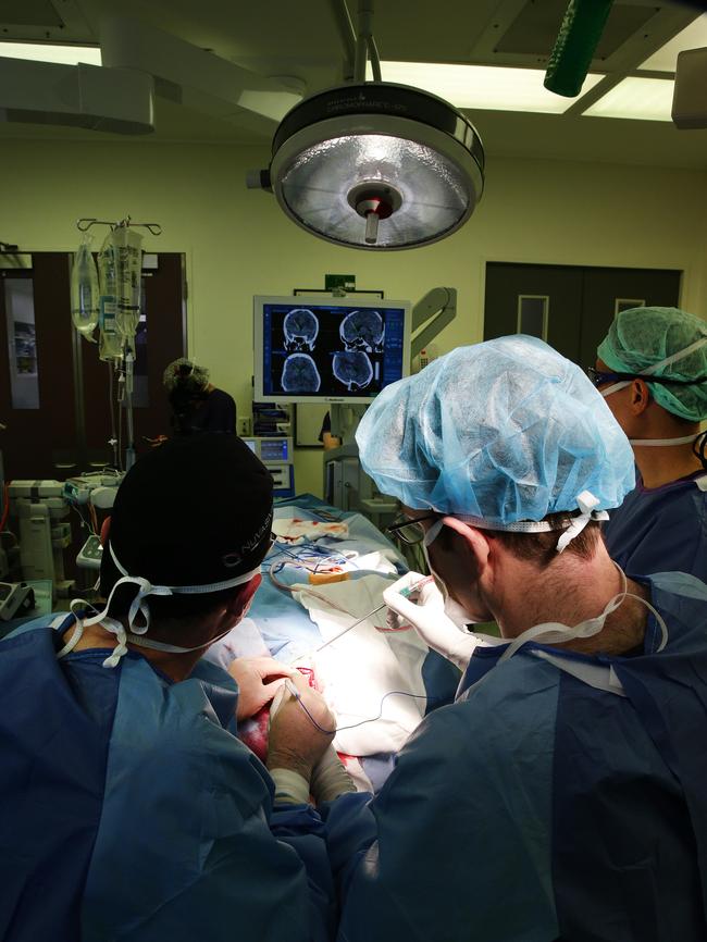 Neurosurgeons Michael Murphy and Kristian Bulluss with neurosurgical registrar Wayne Ng. Picture Andrew Tauber