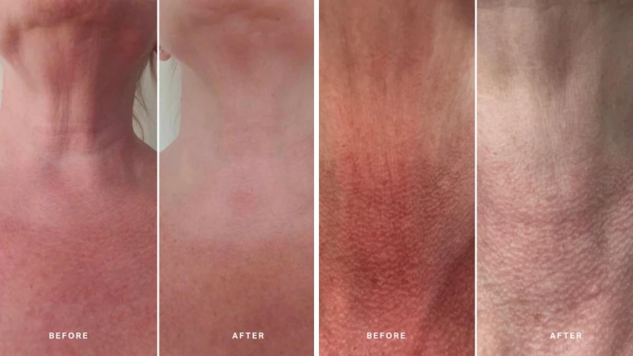 Retinol Reboot Exfoliating Body Treatment. Picture: Alpha-H.