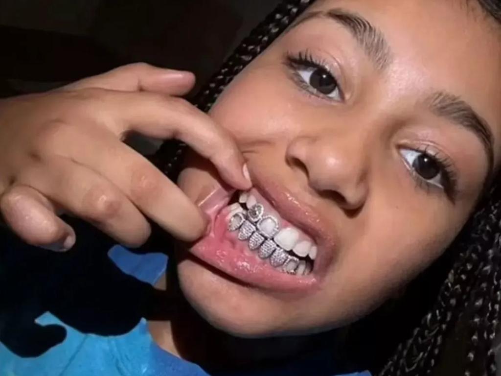 North West debuted her own metal grill on the same day as her dad. Picture: TikTok.