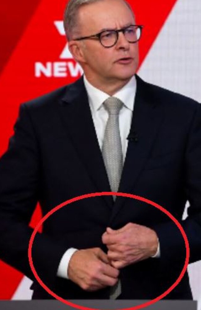 Anthony Albanese fidgets during Wednesday's debate. Picture: Lukas Coch/Getty Images