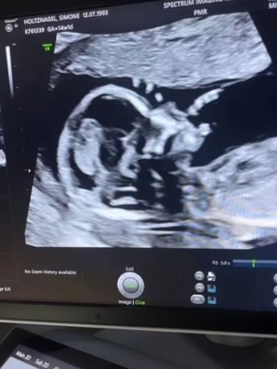 ‘We are beyond excited to share that we are expecting a baby girl.’ Picture: Instagram