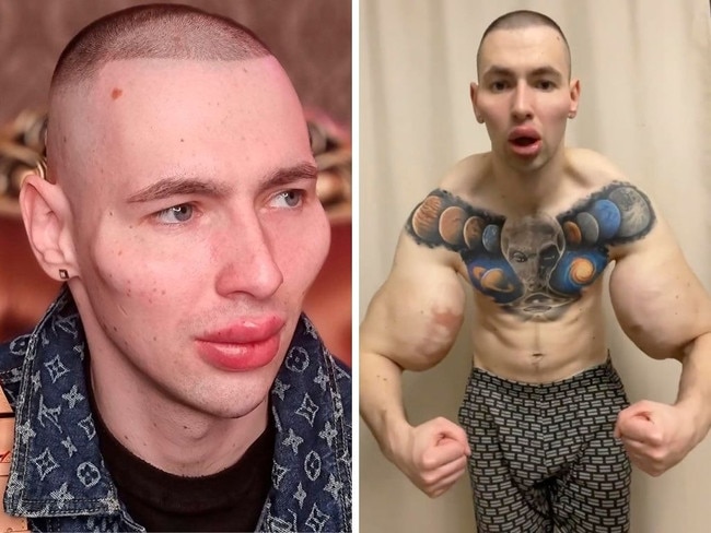 Ex-Russian soldier Kirill Tereshin, 25, is now altering his face.