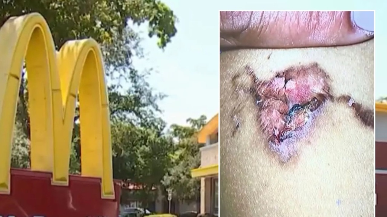 McDonald’s has been ordered to pay $1.2 million to an eight-year-old girl who was burned by a chicken nugget. Picture: NBC Miami