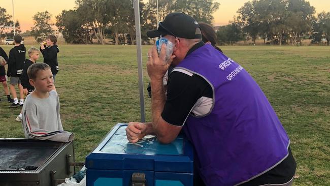 Ground manager Steve Avey holds an ice pack to his face. Photo: Supplied