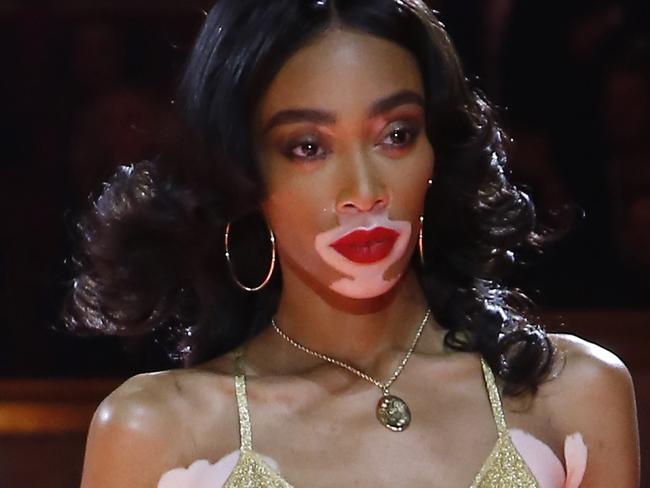 Model Winnie Harlow wears a creation as part of the Tommy Now ready to wear Fall-Winter 2019-2020 collection, that was presented in Paris, Saturday, March 2, 2019. (AP Photo/Michel Euler)