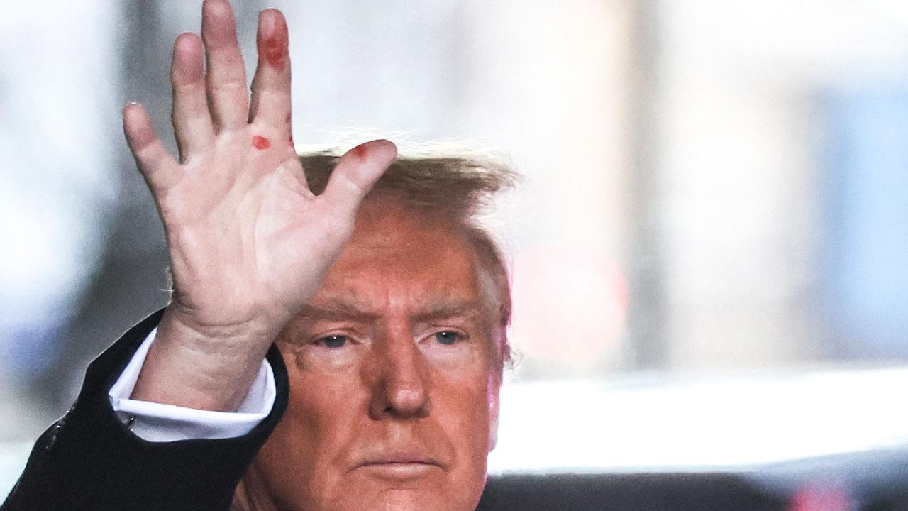 Donald Trump with red blotches on his hand in January 2024. (Photo by Charley TRIBALLEAU / AFP)