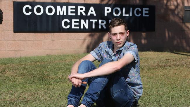 Joshua (last name withheld) and his 16 year old brother were the victims of a brutal homphobic bashing on the Gold Coast at Coomera on Tuesday. Picture Glenn Hampson