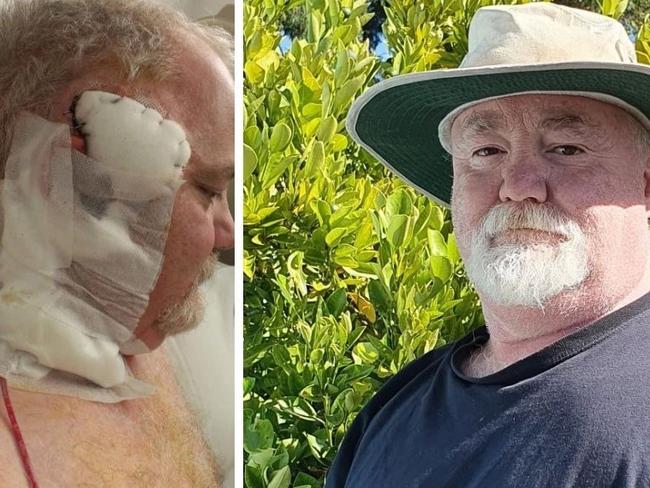 ‘Incredibly lucky’: Man’s horrific cancer battle sparks safety mission