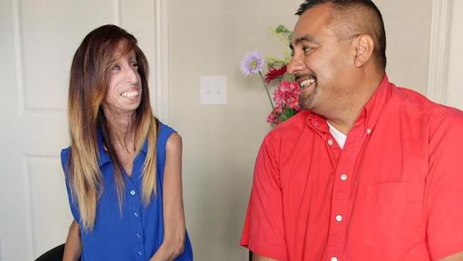 Lizzie Velasquez Why I M Not The ‘the Ugliest Woman In The World Au — Australia S