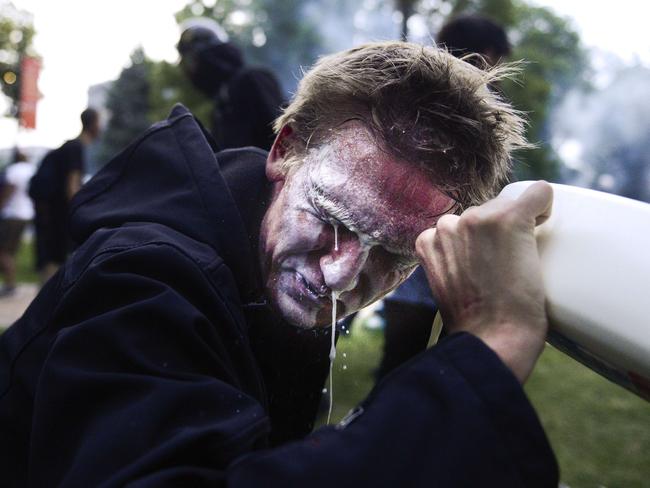 A man who was tear gassed pours milk in his eyes. Picture: Michael Ciaglo