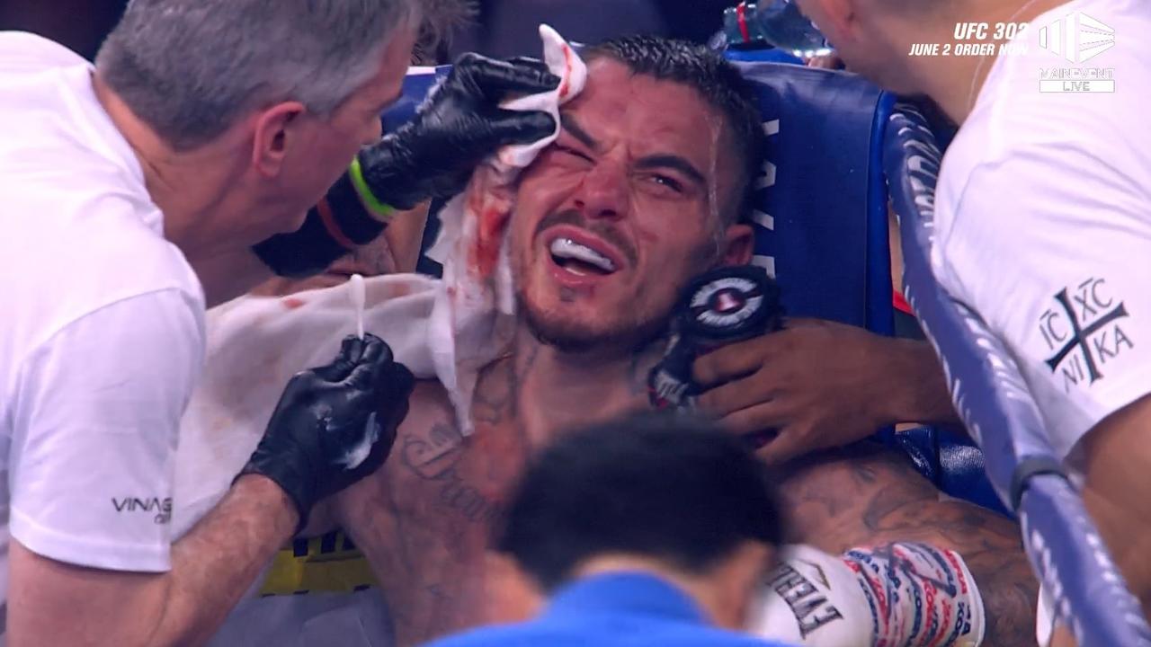 George Kambosos was in a bad way against Lomachenko.