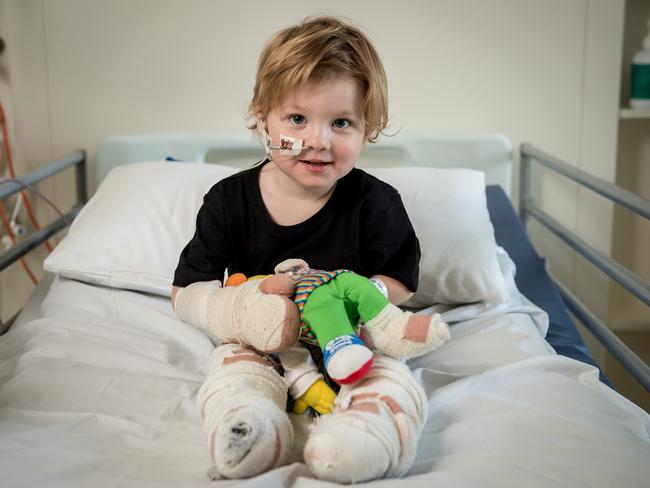 Arthur Long during his recovery from meningococcal at the Royal Children’s Hospital in Melbourne. Picture: JAKE NOWAKOWSKI